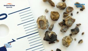 Read more about the article Kenali Cara Mencegah Batu Ginjal yang Dapat Dilakukan