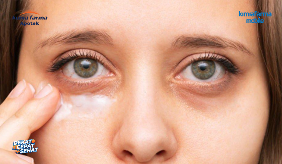 Read more about the article Mengenal Raccoon Eye, Kondisi Lebam di Sekitar Mata